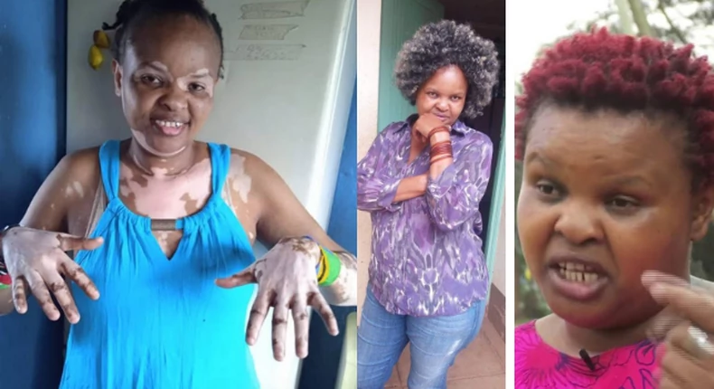 Mama Stella: Ex-Machachari Actress On Facing Discrimination, Lack Of Jobs